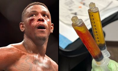 Jamahal Hill reveals list of injuries behind UFC 303 withdrawal, vows to ‘be back soon’