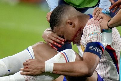 France team bosses sweat over Kylian Mbappé's facial injury