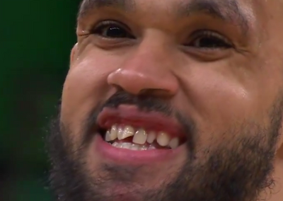 Celtics’ Derrick White flashed a big grin after chipping his tooth on the NBA Finals court