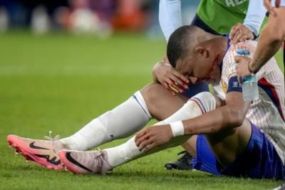Kylian Mbappé Suffers Broken Nose, Faces Uncertain Euro Future