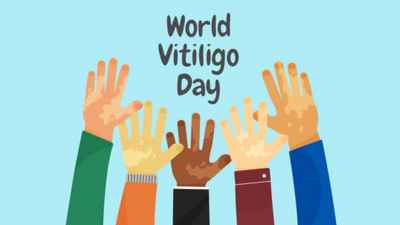 Vitiligo and sun protection: Essential tips
