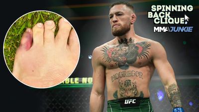 Video: Reacting to Conor McGregor’s injury, timetable for UFC return