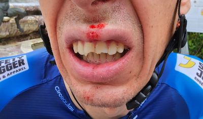 Jan Hirt breaks teeth after fans invade team paddock at Tour de France