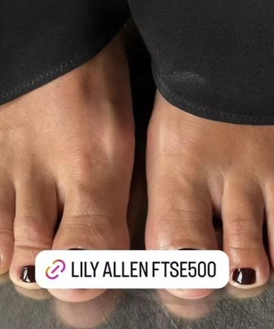 Lily Allen Is Selling Feet Pics On OnlyFans For $10 A Pop After Her Lil Piggies Went Viral