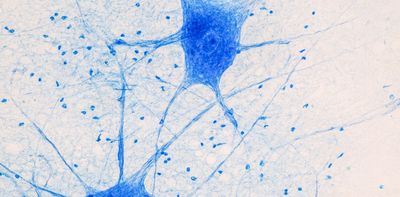 Nanoscopic motor proteins in the brain build the physical structures of memory