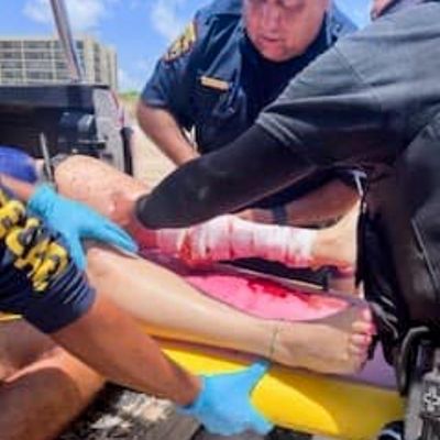 Solo shark bites two and makes contact with two others at Texas beach