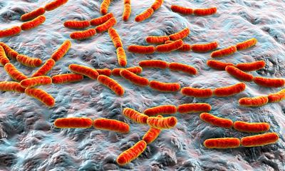 Do gut microbes have a role in autism itself?