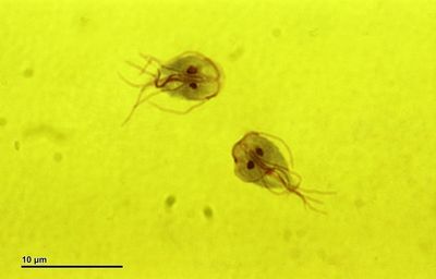 What is Giardia? The stomach bug parasite outbreak which shut down a Liverpool primary school