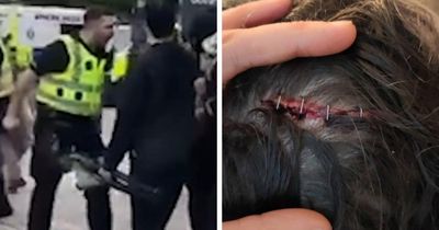 Four hospitalised after 'violent' Police Scotland response to Palestine protest