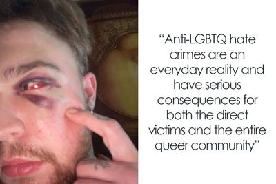 29-Year-Old Trans Man Gets Brutally Beaten Up In Switzerland, Claims It’s A Hate Crime