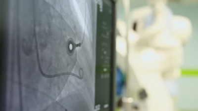 How do pacemakers work in improving heart health