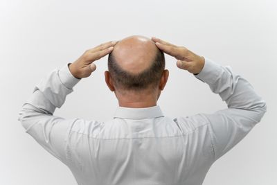 New Treatment For Male Pattern Baldness? Study Identifies Body Sugar That Holds Key