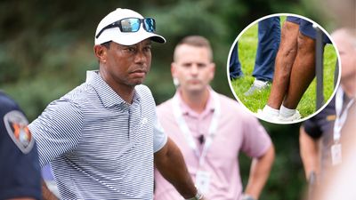 Tiger Woods Shows Leg Injury For First Time Since Near-Fatal Car Crash