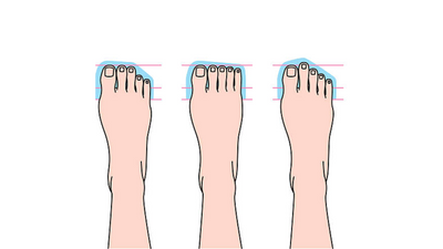 Do you have a longer second toe? Know what different foot shapes mean and what they say about one's personality