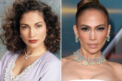 What 14 Famous Stars Looked Like Before Their Stunning Cheekbone Transformations