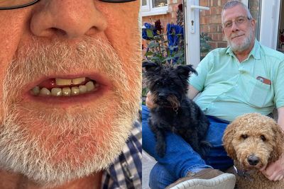 Patient’s huge payout after routine dental surgery could shorten his life by five years