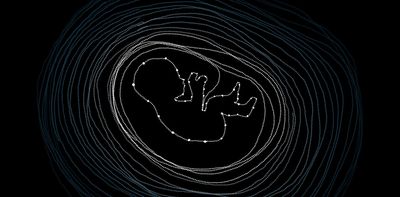 First Nations women are at greater risk of stillbirth. Here’s why – and what we can do about it