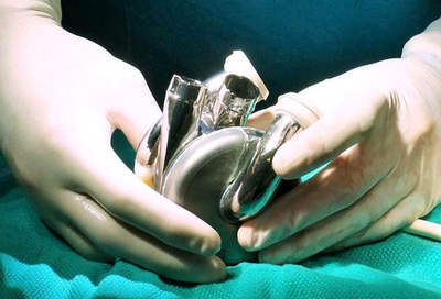 Breakthrough metal heart keeps man alive for days in world first