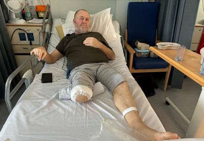 ‘It looked like corned beef’: life inside a Welsh amputation ward – as diabetes gets worse