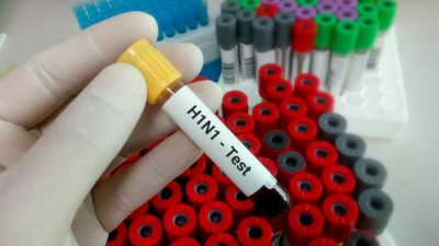 Swine flu in India: Key symptoms to take note of and tips to stay safe