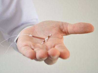 CDC gives doctors new IUD insertion guidelines after TikTok outcry