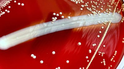 What's the difference between gram-positive and gram-negative bacteria?