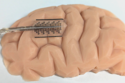 Folding implants that expand in the brain ‘could make epilepsy surgeries safer’