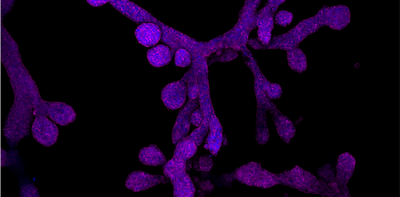 Mammary glands in a dish − what miniature organs reveal about evolution, lactation, regeneration and breast cancer