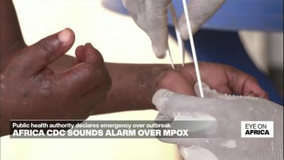 Africa Centres for Disease Control sounds alarm over mpox outbreak