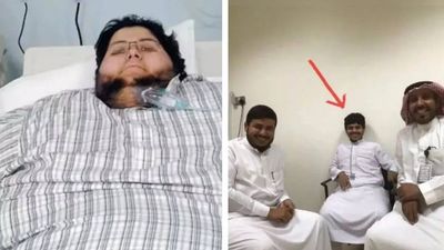 Unbelievable weight loss: World's heaviest man Khalid Shaari sheds 542 kg, now unrecognizable at 63 kg