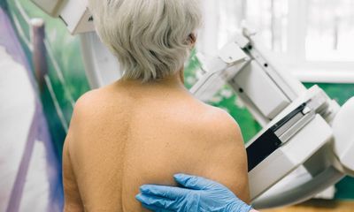 Radiographer shortage in England ‘is delaying breast cancer treatment’