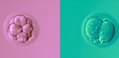 Can AI pick IVF embryos as well as a human? First randomised controlled trial shows promise