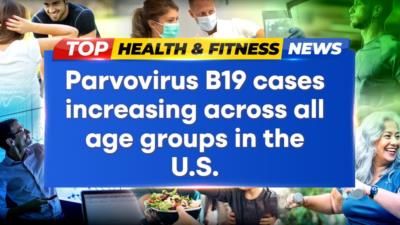 Parvovirus B19 Cases On The Rise In The U.S.