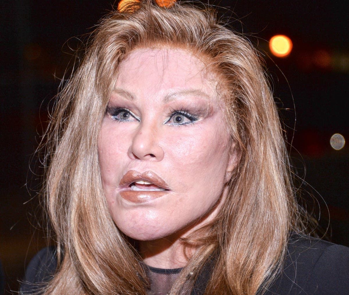 Jocelyn Wildenstein shares throwback photo with her…