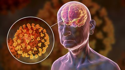 Virus that causes COVID-19 uses a secret 'back door' to infect the brain