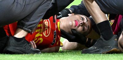 Concussion risks for women footballers are greater than men: why, and what can be done?