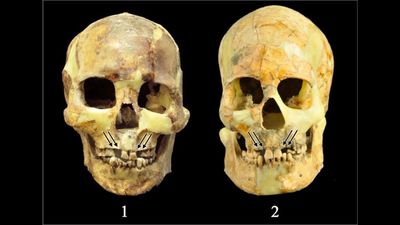 Ancient people in Taiwan yanked healthy teeth from their mouths for 'aesthetic expression' and 'tests of courage,' study finds