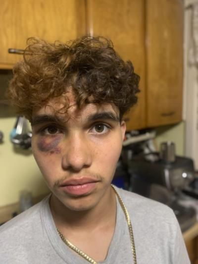 Transgender Teen Allegedly Beaten At Massachusetts High School Party