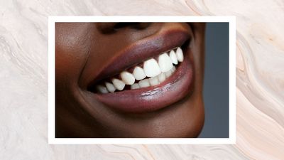 The 7 essential things to know before trying teeth whitening, according to dentists