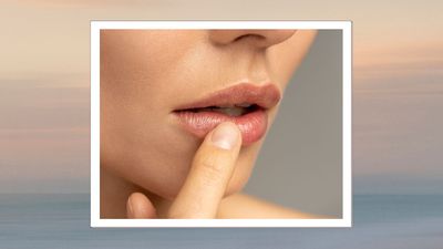 Do lips actually ‘wrinkle’ after filler is dissolved or wears off?