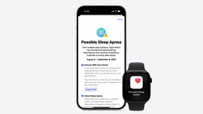 Apple Watch just got a massive health upgrade — Sleep Apnea detection arrives, and you might not have to buy a new model