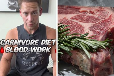 “So Everybody Was Right”: Man Gets Mixed Reactions After Sharing Results Of Carnivore Diet