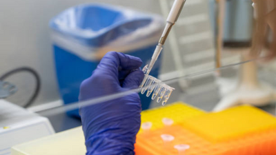 Bengaluru airport on high alert amid Mpox outbreak: Tests and 21-day quarantine for flyers