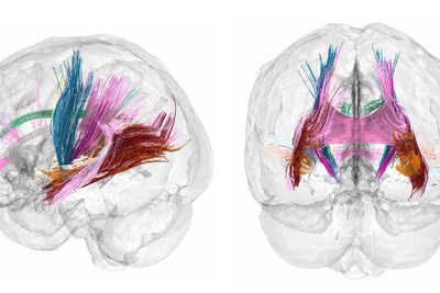 Scans show changes in brain during pregnancy