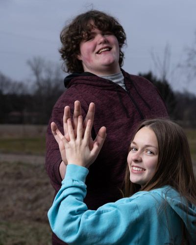 ‘It is OK to stand out’: US teen’s hands and feet are world record-setting