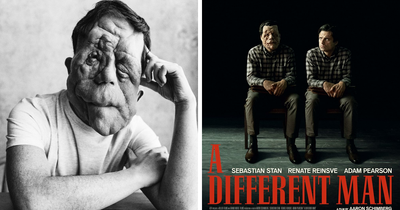 “My Disability Has Opened Doors”: Actor Adam Pearson Wants To Normalize Facial Disfigurement