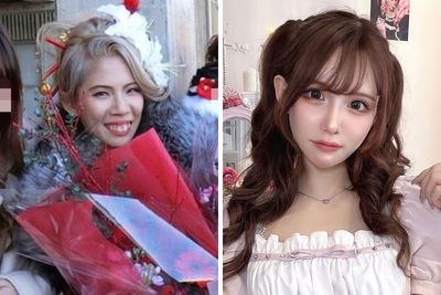 “Finally Beautiful”: Japanese Model Becomes Unrecognizable After 20+ Plastic Surgeries