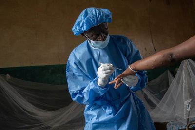 Why is Congo struggling to contain mpox?