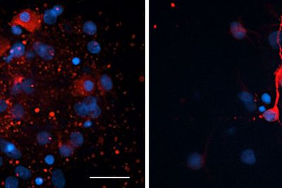 Drugs which switch on vitamin A in the body may stave off MND, research suggests