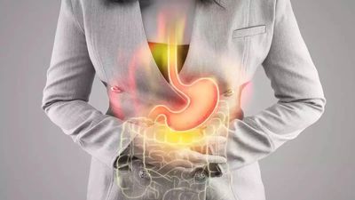 Can lack of sleep cause acidity?